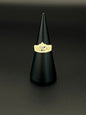 XV's ring